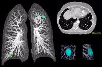 LUNG